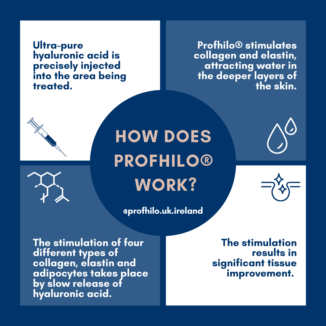Profhilo Treatment Points