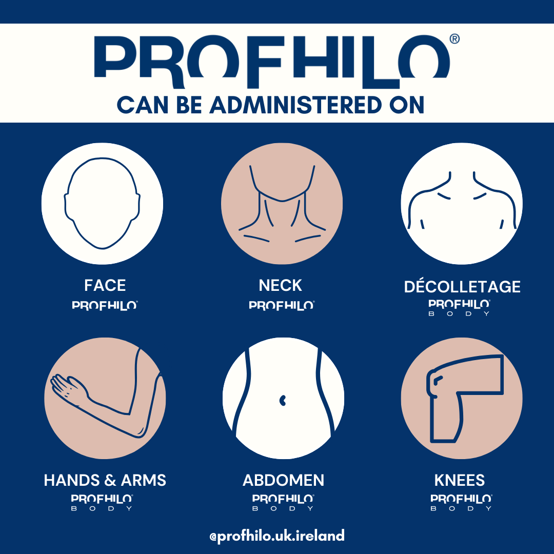 Profhilo Treatment Points