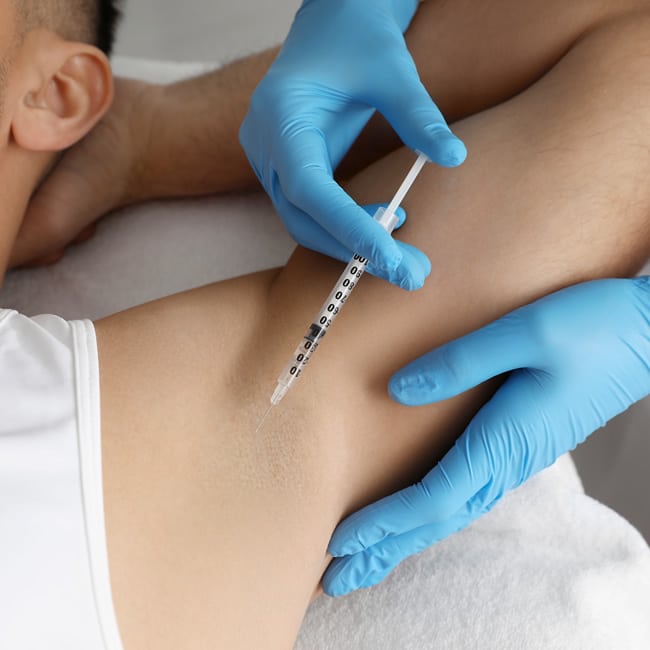 excessive sweating treatment