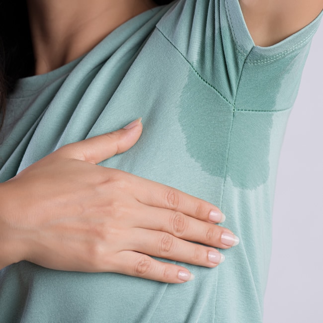 over sweating treatment