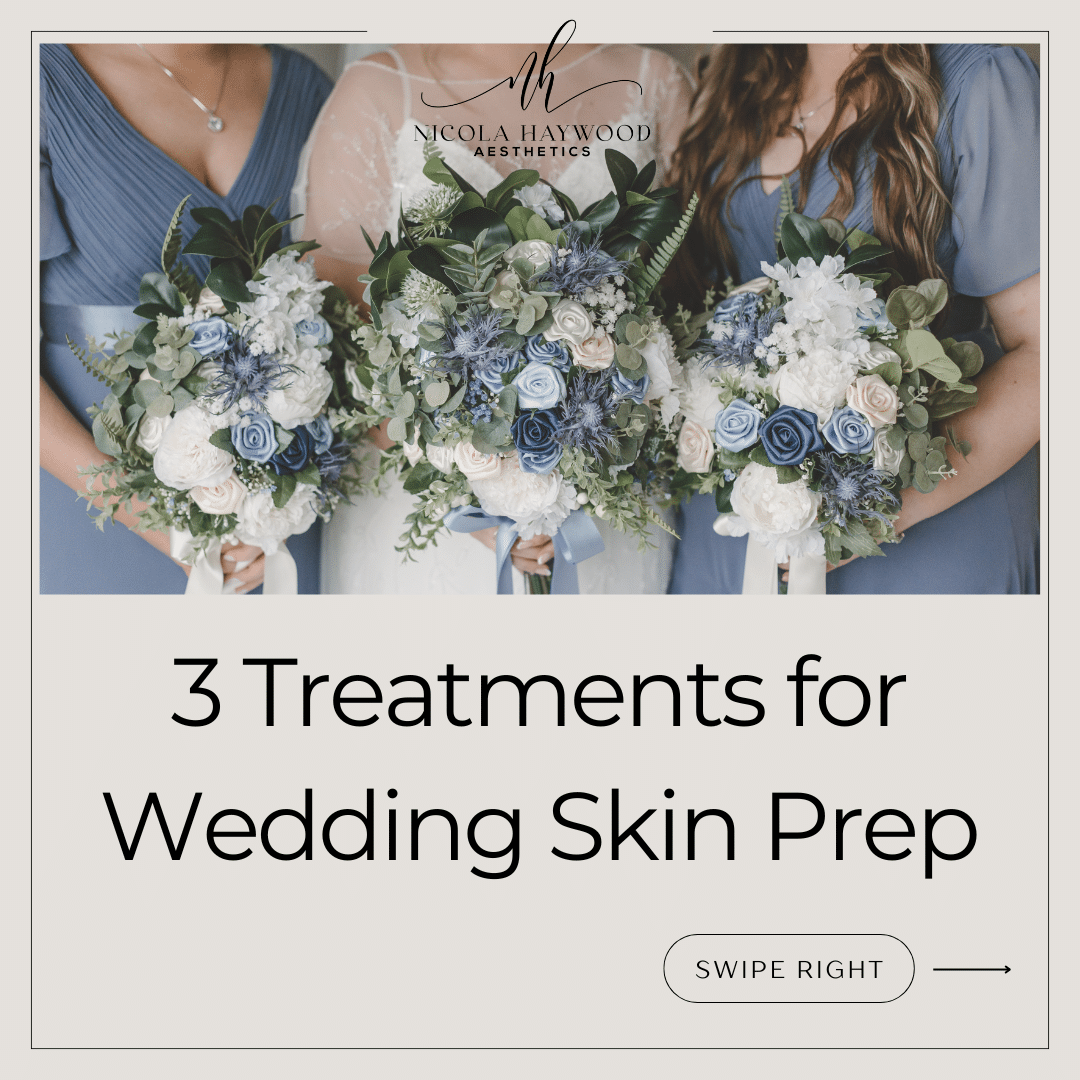 Skin treatments before wedding at Nicola Haywood Aesthetics Wakefield