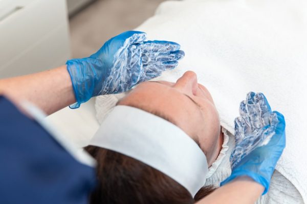 chemical skin peel
