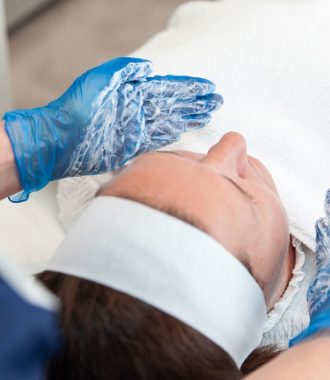 chemical-skin-peel-2