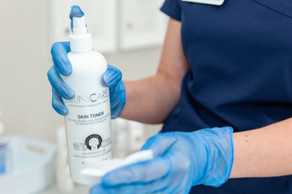 chemical skin peel