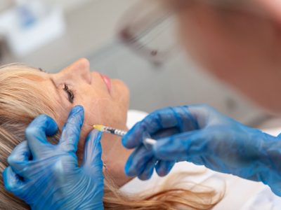 dermal cheek fillers